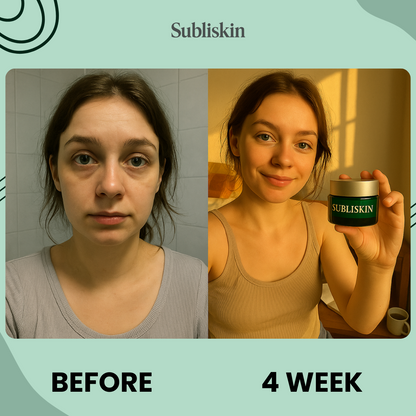 Noctivè Eye Balm - Reduces puffiness, wrinkles & dark circles